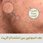 عرض العناية باللحية يضم ماكينة تحديد مع زيتين لتحفيز بصيلات اللحية وترطيبها
